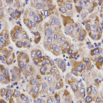 UGT1A9 Rabbit pAb