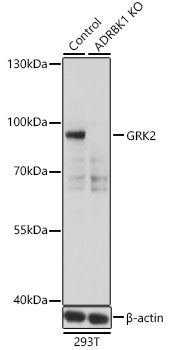 [KO Validated] GRK2 Rabbit pAb
