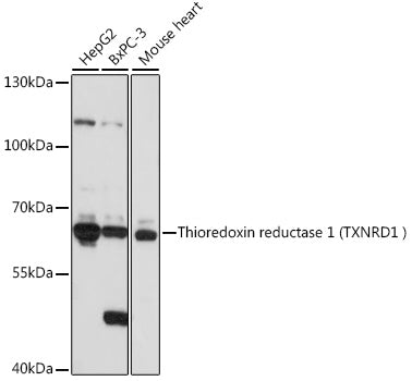 Human Thioredoxin Reductase 1/TRXR1 Rabbit pAb
