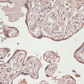 Human Thioredoxin Reductase 1/TRXR1 Rabbit pAb