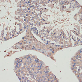 Human Thioredoxin Reductase 1/TRXR1 Rabbit pAb
