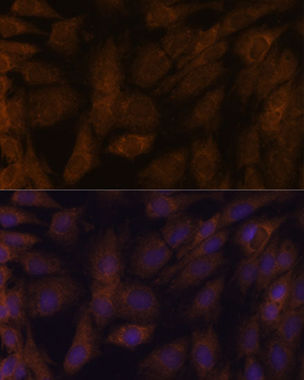 Human Thioredoxin Reductase 1/TRXR1 Rabbit pAb