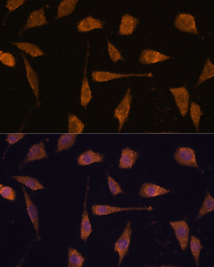 Human Thioredoxin Reductase 1/TRXR1 Rabbit pAb