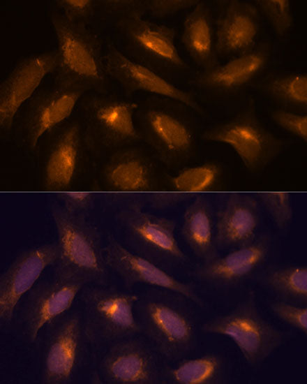 Human Thioredoxin Reductase 1/TRXR1 Rabbit pAb