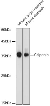 Calponin Rabbit pAb