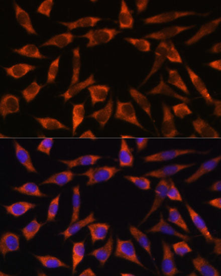 [KO Validated] CHCHD2 Rabbit pAb