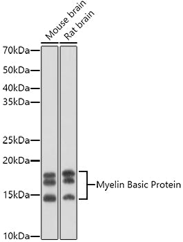 Myelin Basic Protein Rabbit pAb