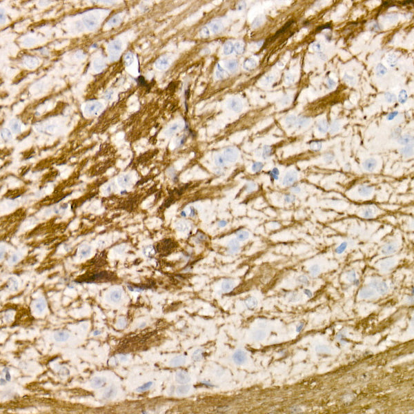 Myelin Basic Protein Rabbit pAb