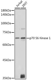 p70 S6 Kinase 1 Rabbit pAb