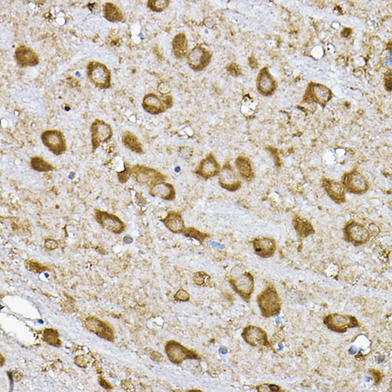 p70 S6 Kinase 1 Rabbit pAb