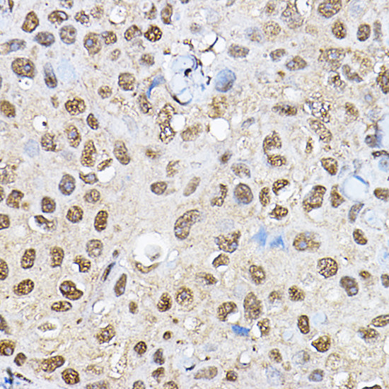 p70 S6 Kinase 1 Rabbit pAb