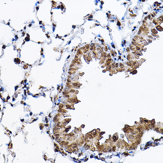p70 S6 Kinase 1 Rabbit pAb