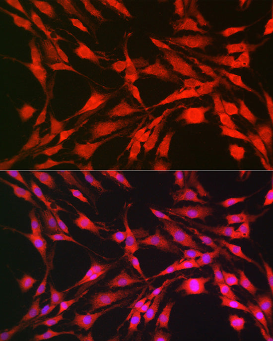 p70 S6 Kinase 1 Rabbit pAb