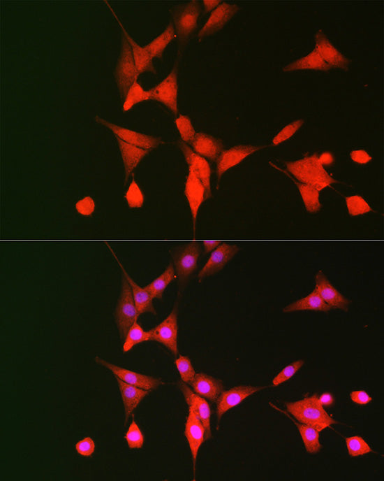p70 S6 Kinase 1 Rabbit pAb