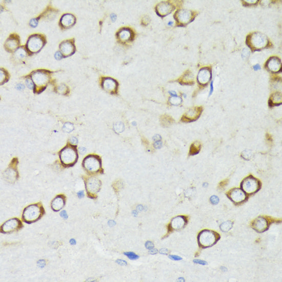 [KO Validated] PDK1/PDPK1 Rabbit pAb