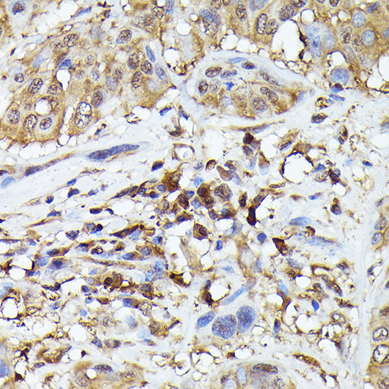 ASC/TMS1 Rabbit pAb