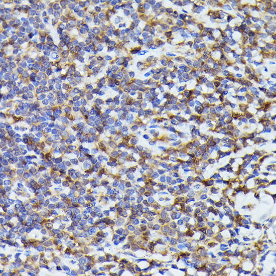 ASC/TMS1 Rabbit pAb