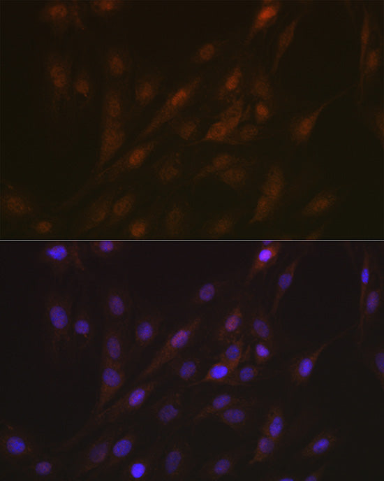 ASC/TMS1 Rabbit pAb