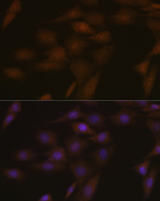 ASC/TMS1 Rabbit pAb