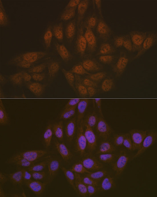 ASC/TMS1 Rabbit pAb