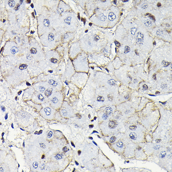 Notch1 Rabbit pAb