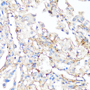 Fibronectin Rabbit pAb