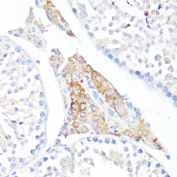 Fibronectin Rabbit pAb