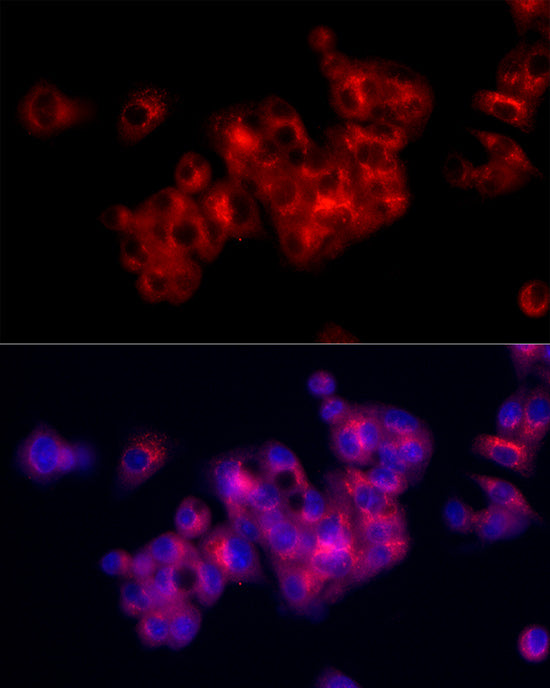 Fibronectin Rabbit pAb