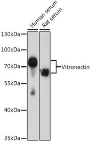 Vitronectin Rabbit pAb