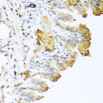 Vitronectin Rabbit pAb