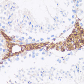 Vitronectin Rabbit pAb