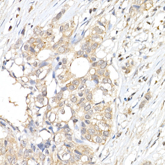 ERK1 / ERK2 Rabbit pAb