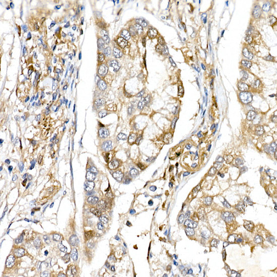 ERK1 / ERK2 Rabbit pAb