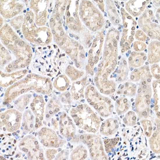ERK1 / ERK2 Rabbit pAb