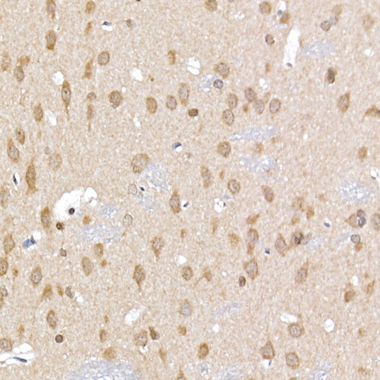 ERK1 / ERK2 Rabbit pAb