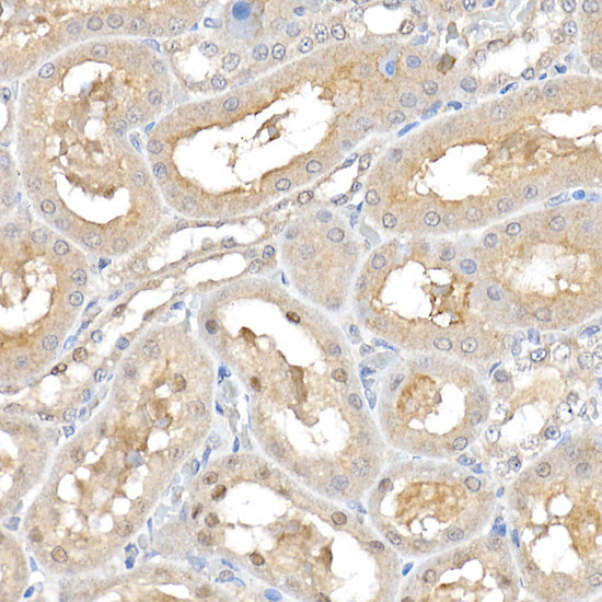 ERK1 / ERK2 Rabbit pAb