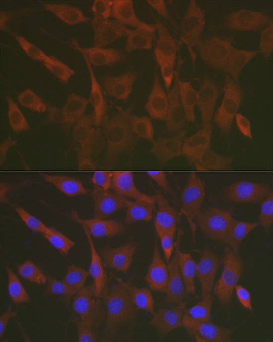 ERK1 / ERK2 Rabbit pAb