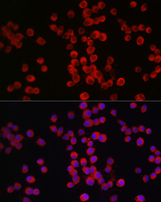 Neuropilin-1 (NRP1) Rabbit pAb