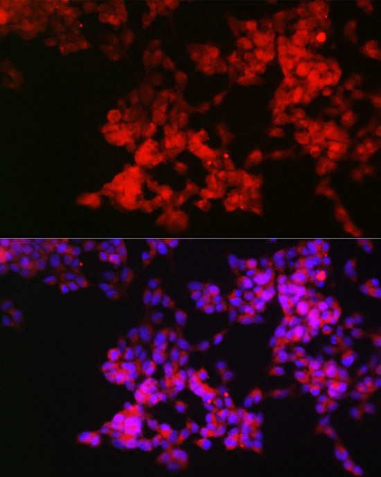 Neuropilin-1 (NRP1) Rabbit pAb