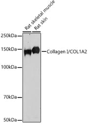 Collagen I/COL1A2 Rabbit pAb