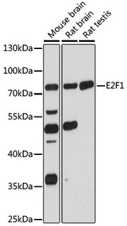E2F1 Rabbit pAb