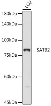 SATB2 Rabbit pAb