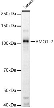 AMOTL2 Rabbit pAb