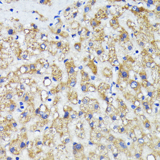 AMOTL2 Rabbit pAb