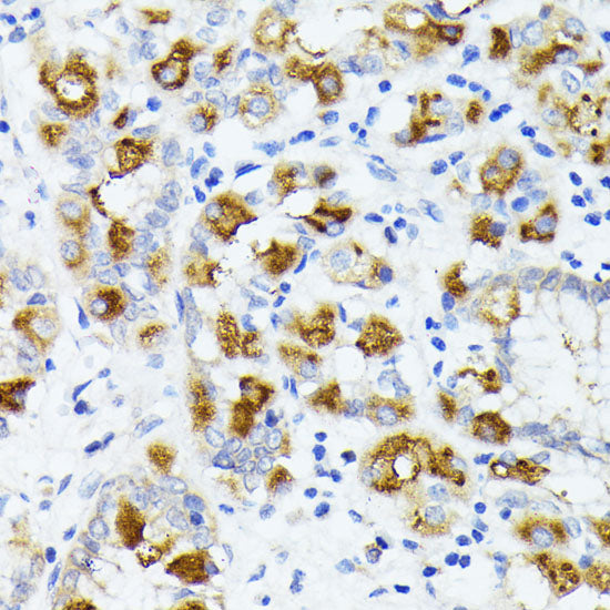 AMOTL2 Rabbit pAb