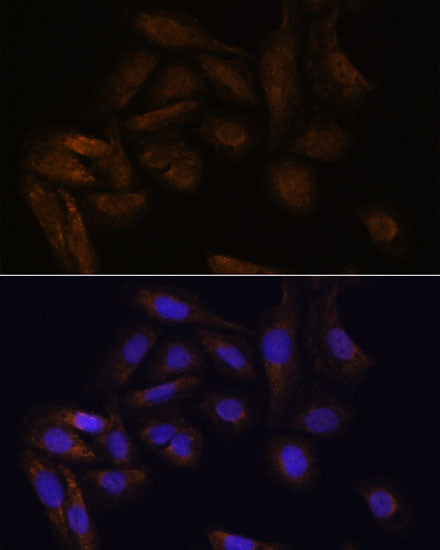 [KO Validated] TFAP4 Rabbit pAb