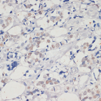 [KD Validated] DNMT1 Rabbit pAb