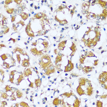 ATP5I Rabbit pAb