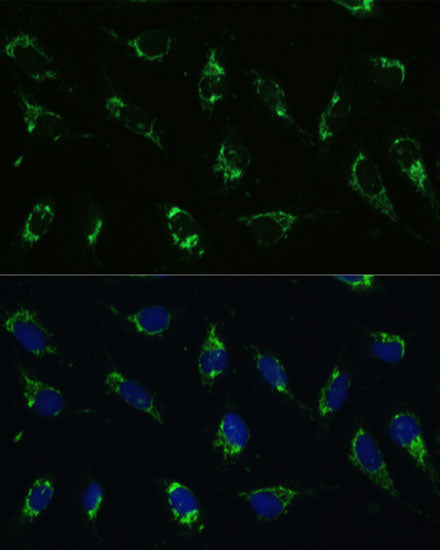 ATP5I Rabbit pAb
