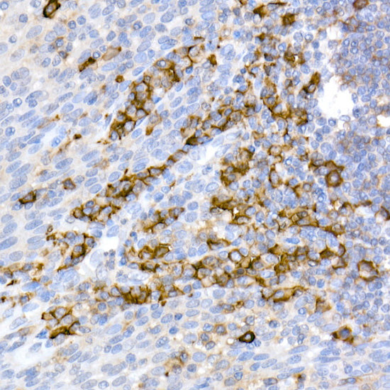 CD38 Rabbit pAb